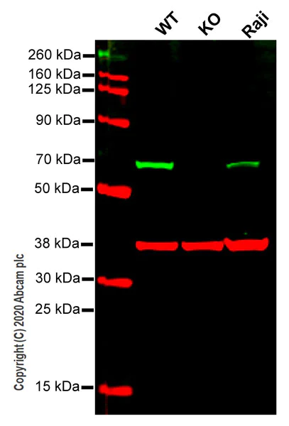 Western blot - Anti-CBS antibody [EPR8578] (AB131155)