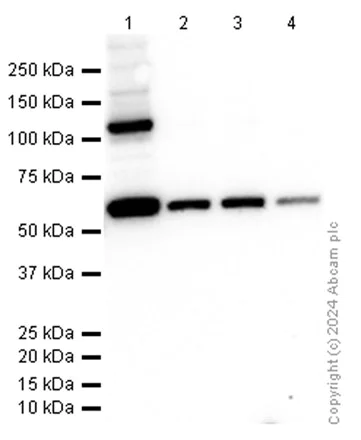 Western blot - Anti-CBS antibody [EPR8578] (AB131155)