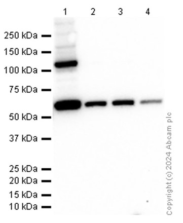 Western blot - Anti-CBS antibody [EPR8578] - BSA and Azide free (AB248359), expandable thumbnail