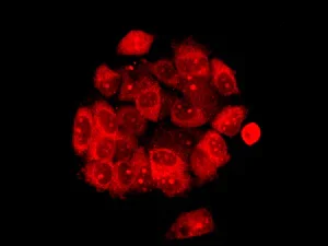 Immunocytochemistry/ Immunofluorescence - Anti-CBS antibody [EPR8579] (AB140600)