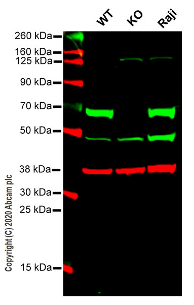 Western blot - Anti-CBS antibody [EPR8579] - BSA and Azide free (AB248895), expandable thumbnail