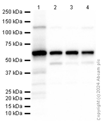 Western blot - Anti-CBS antibody [EPR8579] - BSA and Azide free (AB248895), expandable thumbnail