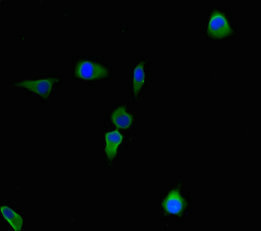 Immunocytochemistry/ Immunofluorescence - Anti-CBWD2 antibody (AB237050)