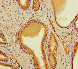 Immunohistochemistry (Formalin/PFA-fixed paraffin-embedded sections) - Anti-CBWD2 antibody (AB237050)