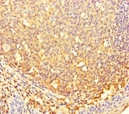 Immunohistochemistry (Formalin/PFA-fixed paraffin-embedded sections) - Anti-CBWD2 antibody (AB237050)