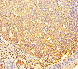 Immunohistochemistry (Formalin/PFA-fixed paraffin-embedded sections) - Anti-CBWD2 antibody (AB237050)