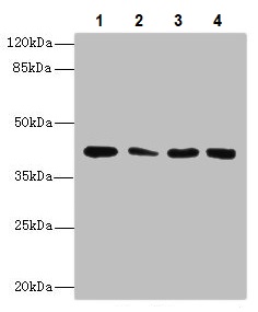 Western blot - Anti-CBWD2 antibody (AB237050)