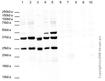 Anti-CBX1 / HP1 beta antibody