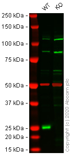 Western blot - Anti-CBX1 / HP1 beta antibody (AB10478)