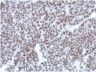 Immunohistochemistry (Formalin/PFA-fixed paraffin-embedded sections) - Anti-CBX1 / HP1 beta antibody (AB152144), expandable thumbnail