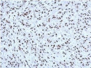 Immunohistochemistry (Formalin/PFA-fixed paraffin-embedded sections) - Anti-CBX1 / HP1 beta antibody (AB152144), expandable thumbnail