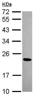 Western blot - Anti-CBX1 / HP1 beta antibody (AB152144)