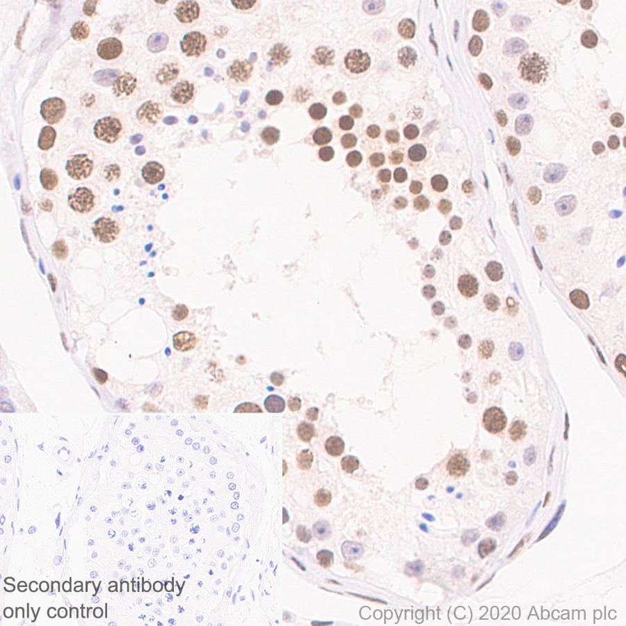 Immunohistochemistry (Formalin/PFA-fixed paraffin-embedded sections) - Anti-CBX1 / HP1 beta antibody [EPR24242-78] (ab270988), expandable thumbnail