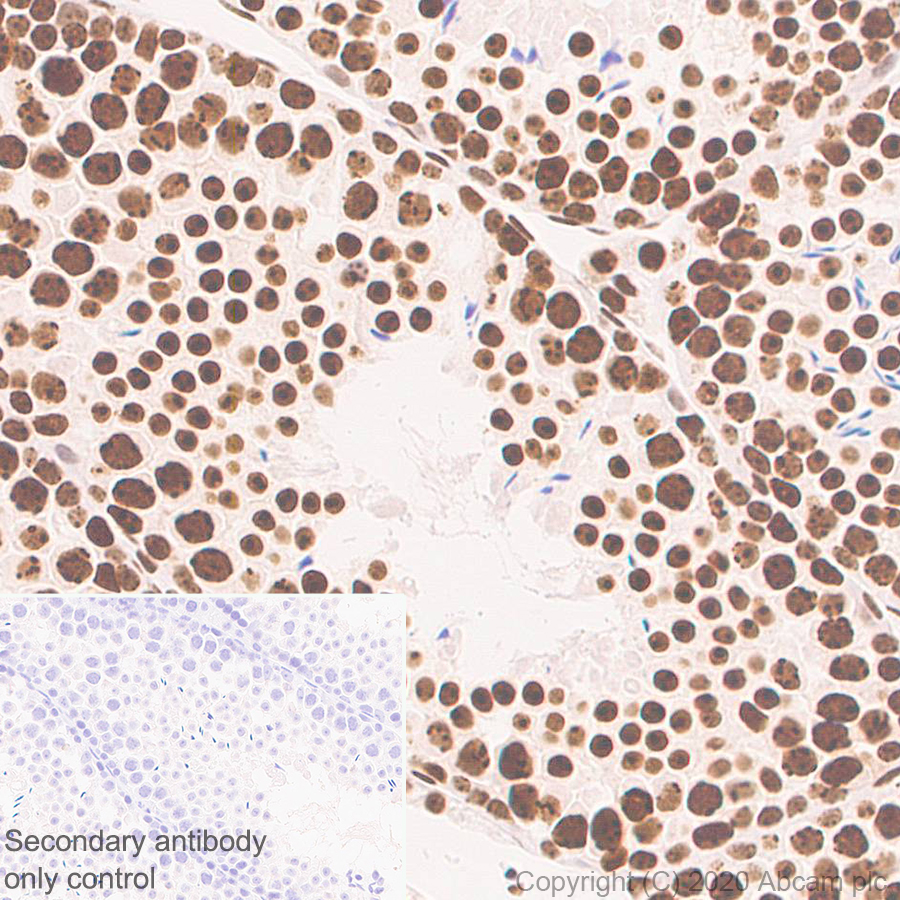 Immunohistochemistry (Formalin/PFA-fixed paraffin-embedded sections) - Anti-CBX1 / HP1 beta antibody [EPR24242-78] (ab270988), expandable thumbnail
