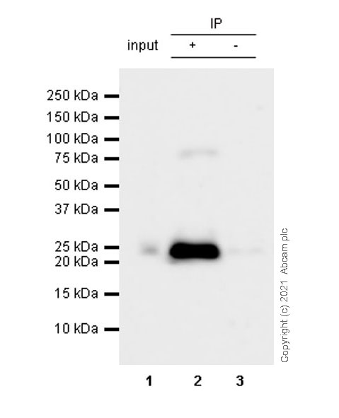 Immunoprecipitation - Anti-CBX1 / HP1 beta antibody [EPR24242-78] (ab270988), expandable thumbnail