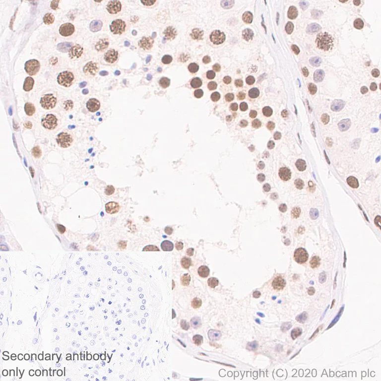 Immunohistochemistry (Formalin/PFA-fixed paraffin-embedded sections) - Anti-CBX1 / HP1 beta antibody [EPR24242-78] - BSA and Azide free (AB288568)