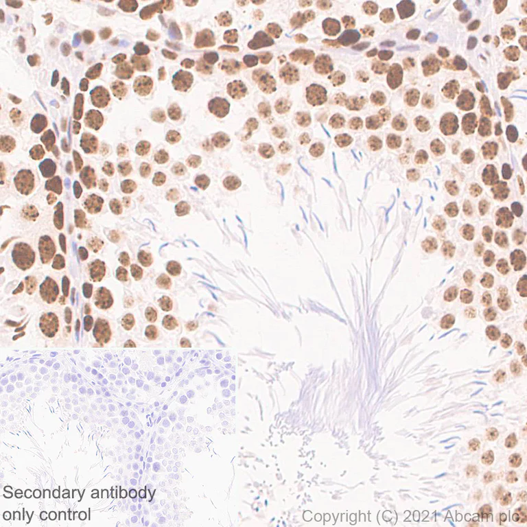 Immunohistochemistry (Formalin/PFA-fixed paraffin-embedded sections) - Anti-CBX1 / HP1 beta antibody [EPR24242-78] - BSA and Azide free (AB288568)