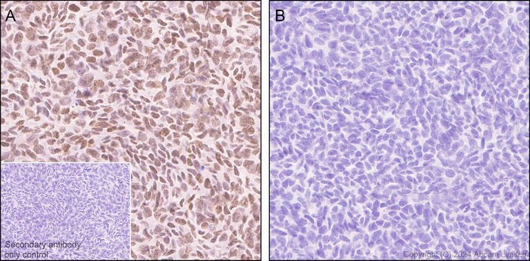 Immunohistochemistry (Formalin/PFA-fixed paraffin-embedded sections) - Anti-CBX1 / HP1 beta antibody [MAC353] - BSA and Azide free (AB324761)