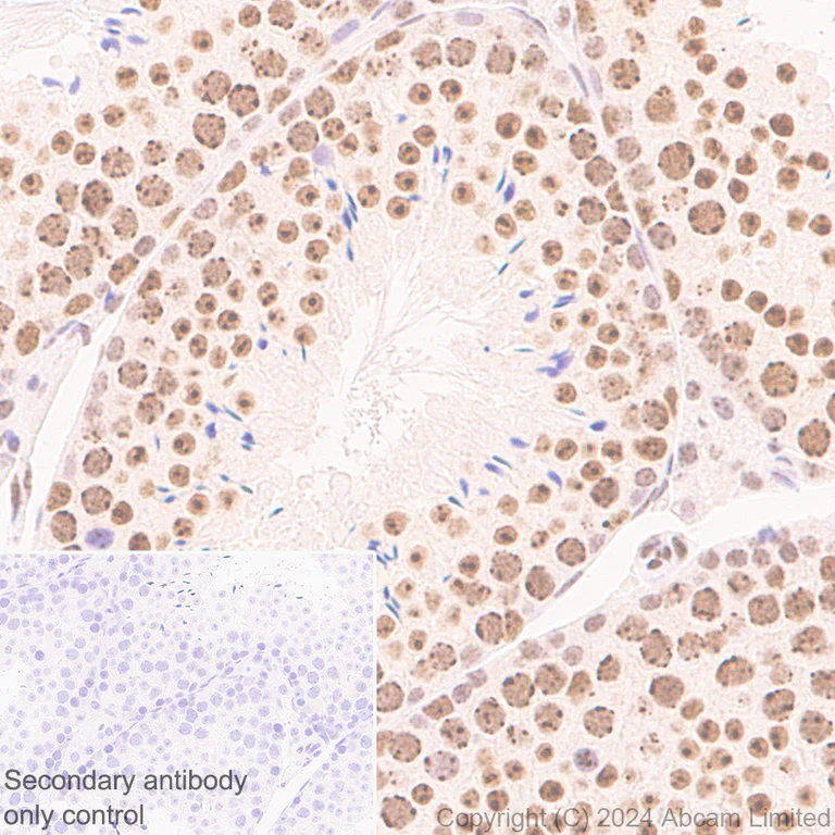 Immunohistochemistry (Formalin/PFA-fixed paraffin-embedded sections) - Anti-CBX1 / HP1 beta antibody [MAC353] - BSA and Azide free (AB324761)