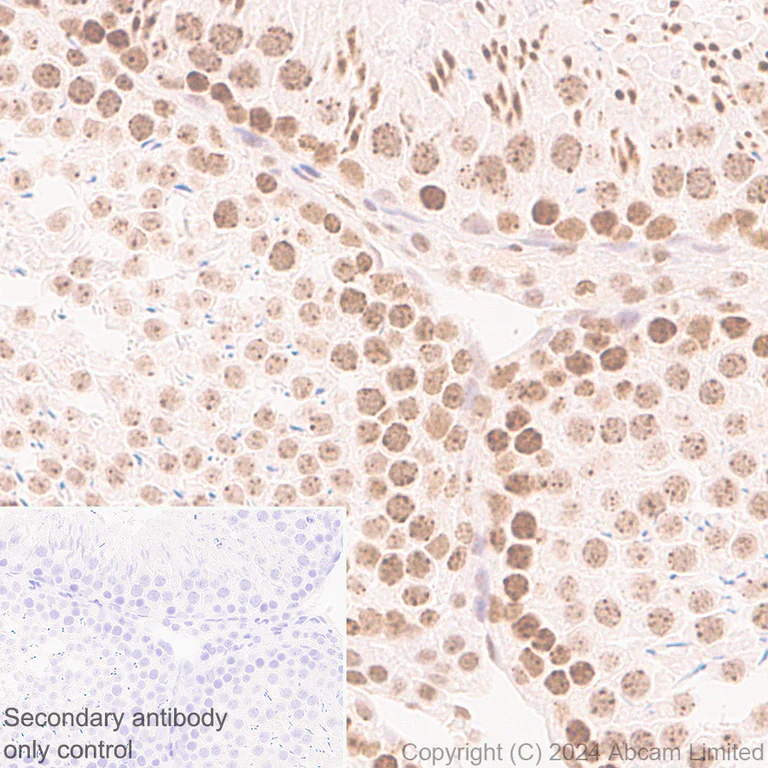 Immunohistochemistry (Formalin/PFA-fixed paraffin-embedded sections) - Anti-CBX1 / HP1 beta antibody [MAC353] - BSA and Azide free (AB324761)