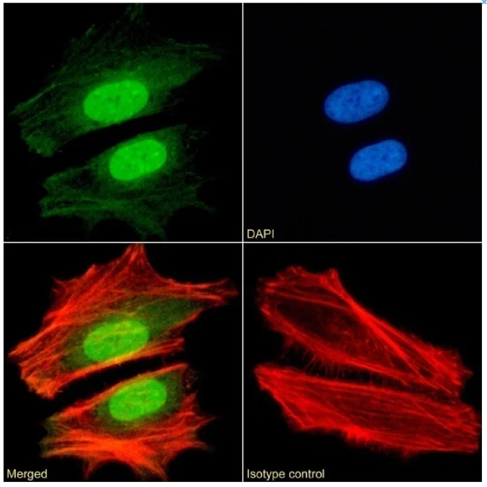 Immunocytochemistry/ Immunofluorescence - Anti-CBX1 / HP1 beta antibody [RAB-C145] (AB317723)