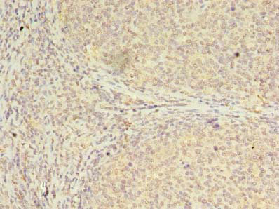 Immunohistochemistry (Formalin/PFA-fixed paraffin-embedded sections) - Anti-CBX2 antibody (AB235305), expandable thumbnail