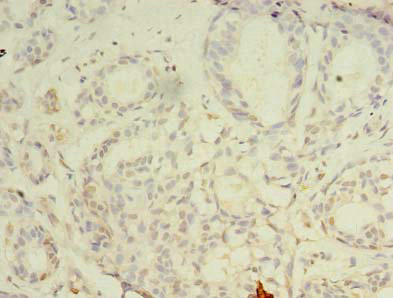Immunohistochemistry (Formalin/PFA-fixed paraffin-embedded sections) - Anti-CBX2 antibody (AB235305), expandable thumbnail