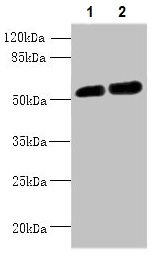Western blot - Anti-CBX2 antibody (AB235305), expandable thumbnail