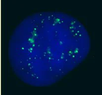 Immunocytochemistry/ Immunofluorescence - Anti-CBX4 antibody (AB4189)