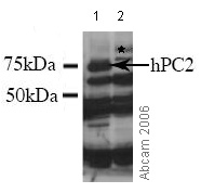 Western blot - Anti-CBX4 antibody (AB4189), expandable thumbnail