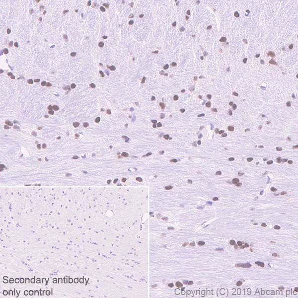 Immunohistochemistry (Formalin/PFA-fixed paraffin-embedded sections) - Anti-CBX4 antibody [EPR23053-7] - ChIP Grade (AB242149)