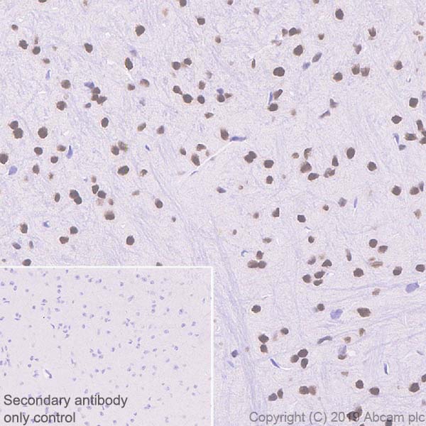 Immunohistochemistry (Formalin/PFA-fixed paraffin-embedded sections) - Anti-CBX4 antibody [EPR23053-7] - ChIP Grade - BSA and Azide free (ab269462), expandable thumbnail