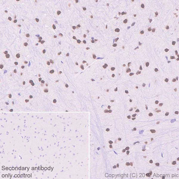 Immunohistochemistry (Formalin/PFA-fixed paraffin-embedded sections) - Anti-CBX4 antibody [EPR23053-7] - ChIP Grade - BSA and Azide free (AB269462)