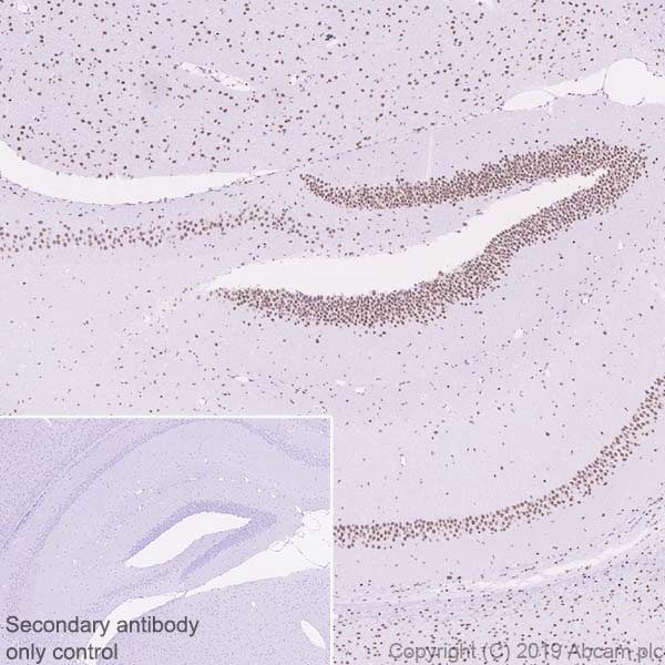Immunohistochemistry (Formalin/PFA-fixed paraffin-embedded sections) - Anti-CBX4 antibody [EPR23053-7] - ChIP Grade - BSA and Azide free (ab269462), expandable thumbnail