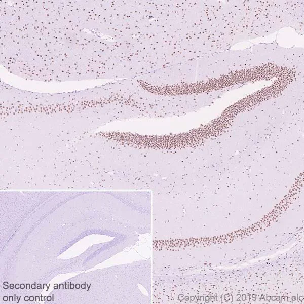 Immunohistochemistry (Formalin/PFA-fixed paraffin-embedded sections) - Anti-CBX4 antibody [EPR23053-7] - ChIP Grade - BSA and Azide free (AB269462)