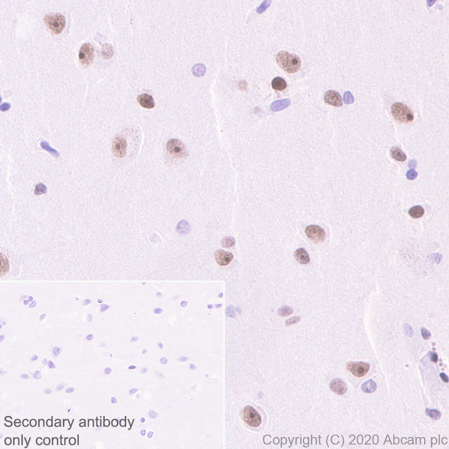 Immunohistochemistry (Formalin/PFA-fixed paraffin-embedded sections) - Anti-Cbx6 antibody [EPR23828-108] (AB259848)