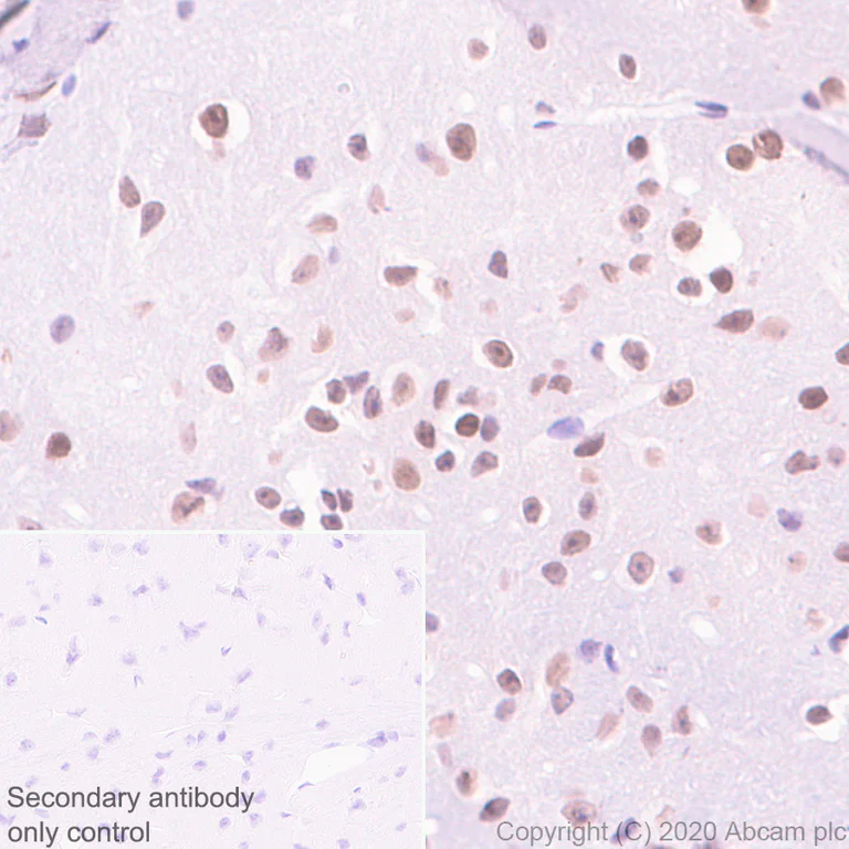 Immunohistochemistry (Formalin/PFA-fixed paraffin-embedded sections) - Anti-Cbx6 antibody [EPR23828-108] - BSA and Azide free (AB279707)