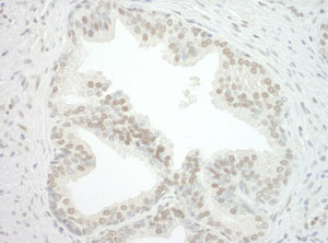 Immunohistochemistry (Formalin/PFA-fixed paraffin-embedded sections) - Anti-cbx7 antibody (AB123492)