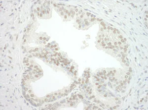 Immunohistochemistry (Formalin/PFA-fixed paraffin-embedded sections) - Anti-cbx7 antibody (AB123492)