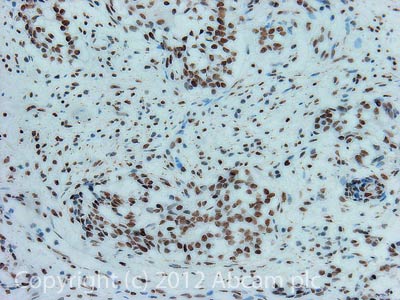 Immunohistochemistry (Formalin/PFA-fixed paraffin-embedded sections) - Anti-cbx7 antibody (AB21873)