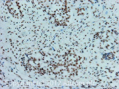Immunohistochemistry (Formalin/PFA-fixed paraffin-embedded sections) - Anti-cbx7 antibody (AB21873)