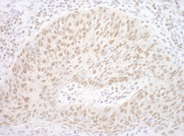 Immunohistochemistry (Formalin/PFA-fixed paraffin-embedded sections) - Anti-cbx7 antibody (AB91431)