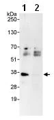 Immunoprecipitation - Anti-cbx7 antibody (AB91431)