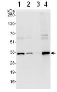 Western blot - Anti-cbx7 antibody (AB91431)