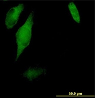 Immunocytochemistry/ Immunofluorescence - Anti-CC2D1A antibody (AB68302)