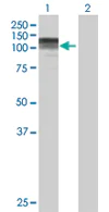 Western blot - Anti-CC2D1A antibody (AB68302)