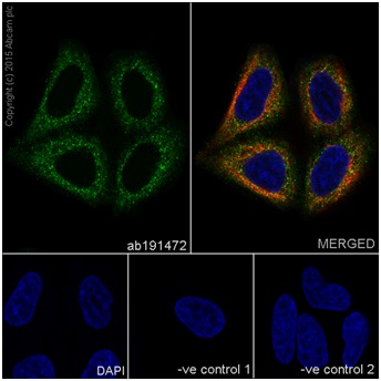 Immunocytochemistry/ Immunofluorescence - Anti-CC2D1A antibody [EPR18421] (AB191472), expandable thumbnail