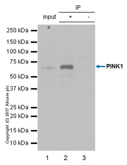 Immunoprecipitation - CCCP, Mitochondrial oxidative phosphorylation uncoupler (AB141229), expandable thumbnail