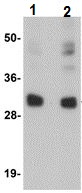 Western blot - Anti-CCDC106 antibody (AB105354)