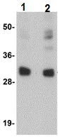 Western blot - Anti-CCDC106 antibody (AB105354)